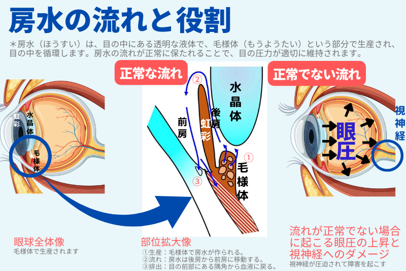 ミオピアが房水の流れに与える効果